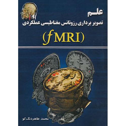 علم تصویربرداری رزونانس مغناطیسی عملکردی FMRI / امیدانقلاب