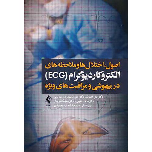 اصول، اختلال ها و ملاحظه های الکتروکاردیوگرام (ECG) در بیهوشی و مراقبت های ویژه