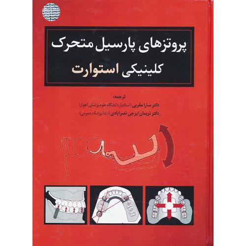 پروتزهای پارسیل متحرک کلینیکی استوارت 2008 / رویان پژوه