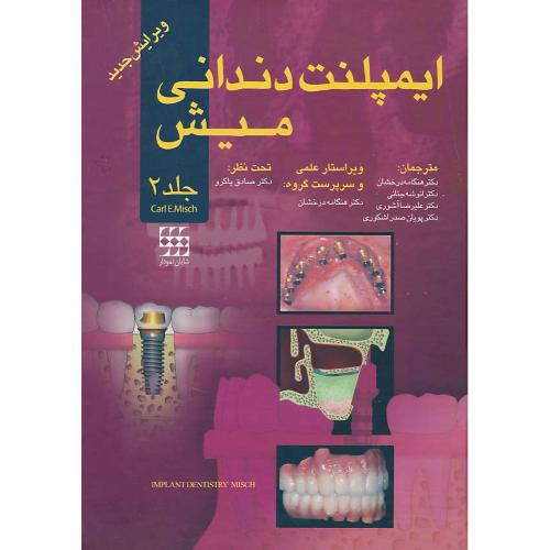 ایمپلنت دندانی میش 2008 (2ج) باقاب / شایان نمودار